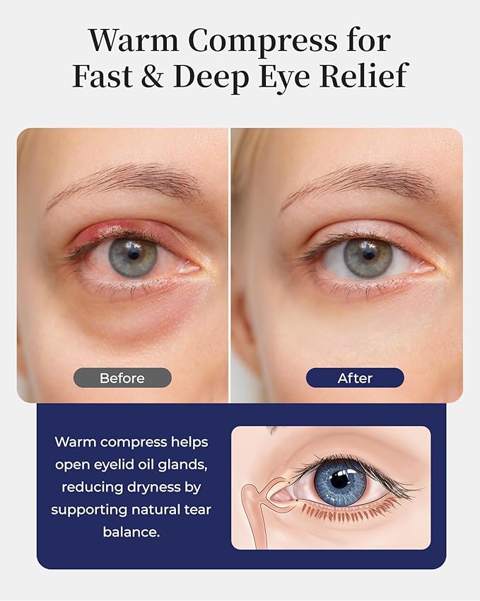 Silk Heated Eye Mask for Dry Eyes: Warm Eye Compress for Stye, Blepharitis & Chalazion - USB Electric Stable Eye Heating Pads for MGD, FSA - HSA Eligible, Ideal for Sleep & Travel