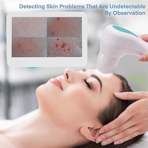 Beauty Star Scalp Analysis Machine, 12 inches Skin Tester Diagnosis Digital Analyzer Tool, Profesional Hair Detector Microscope, HairFollicle Health Detection Camera for Head Spa, Salon and Home Use