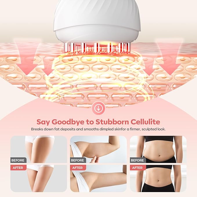 Lymphatic Drainage Massager & Anti Cellulite Massage Tool,New Lymphatic Massager,Helps Reduce Stretch Marks & Cellulite，for Belly, Arms & Legs,Body Sculpting Machine with Heat & Vibration
