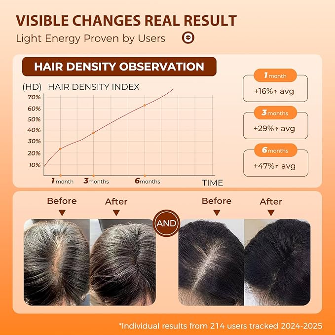 Laser Therapy Hair Growth Comb,Red Light Therapy for Hair Growth Electric Scalp Massager, Promote Hair Regrowth in Women and Men Hair Loss