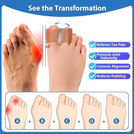 Bunion Toe Separators for Overlapping Toes, 3-Point Support Gel Toe Spacers with 2 Fabric Lining Loops for Toe Protectors, Bunion Corrector for Women Men Big Toe (4 Pack, L)
