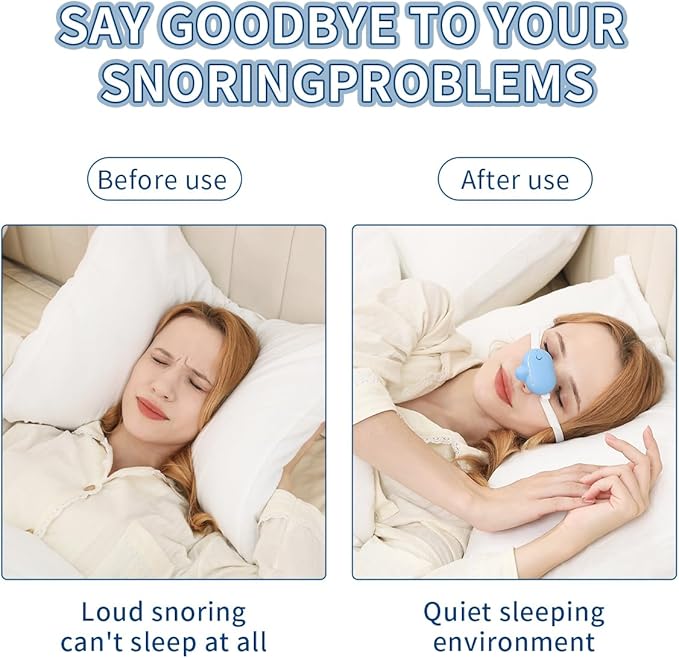 Smart Anti-Snoring Device,Smart Snore Stopper with Strong and Weak Modes for Snoring Reminder,Relief.Easy Use,AI Automatic Monitoring Portable Snore Solution for Home Office Travel