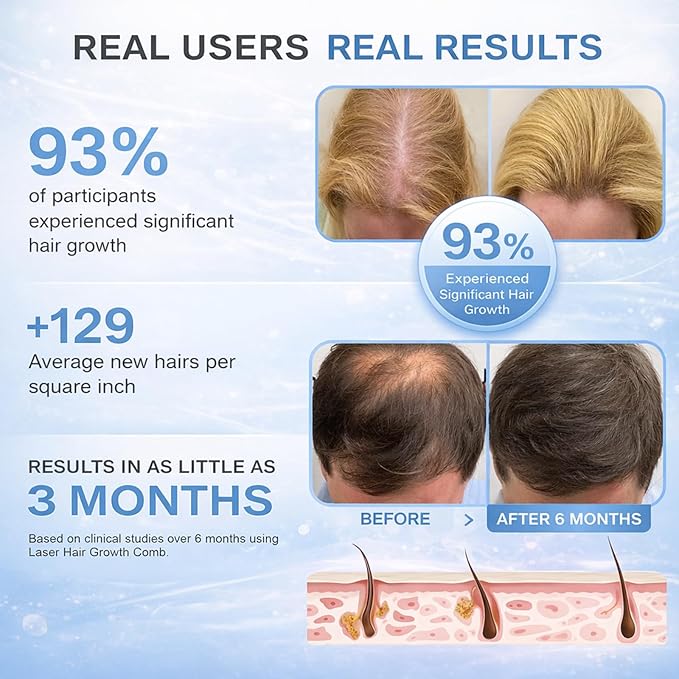 Obiredk ㅤLaser Hair Growth Comb - Lasers & LEDs for Hair Regrowth - FDA Cleared Rechargeable Scalp Massager for Men Women - Effective for Thinning Crown, Receding Hairline - White