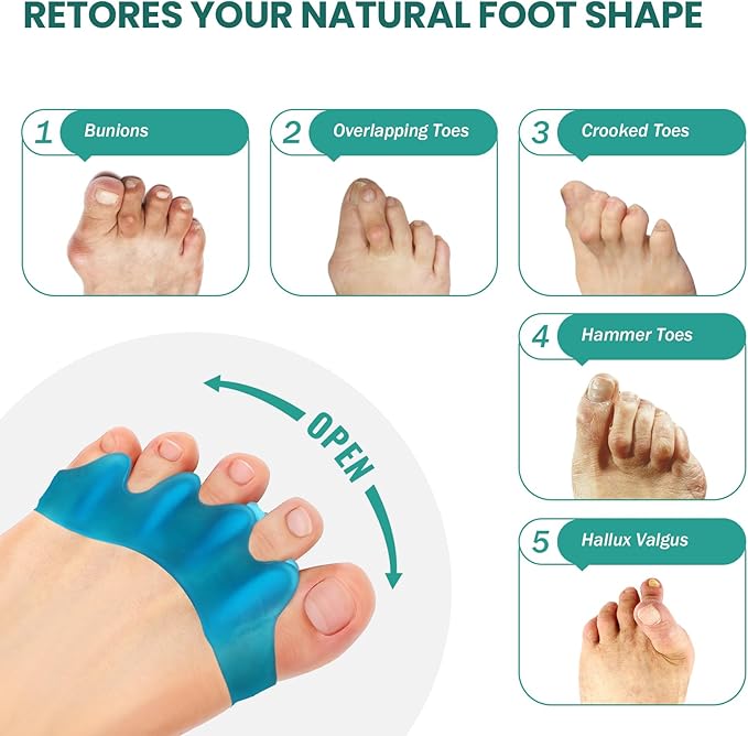 Welnove Silicone Toe Separators for Correct Bunion - 8 Pack Toe Spacers for Feet Men - Hammertoe Straighteners for Women, Yoga Practice, Foot Alignment FSA or HSA Eligible