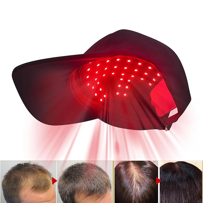 LLLT Laser Hair Growth Cap, Hair Growth Cap for Men Women - Lasers & LED Light Therapy Cap-Rechargeable Portable Laser Hair Growth Cap to Promote Hair Growth