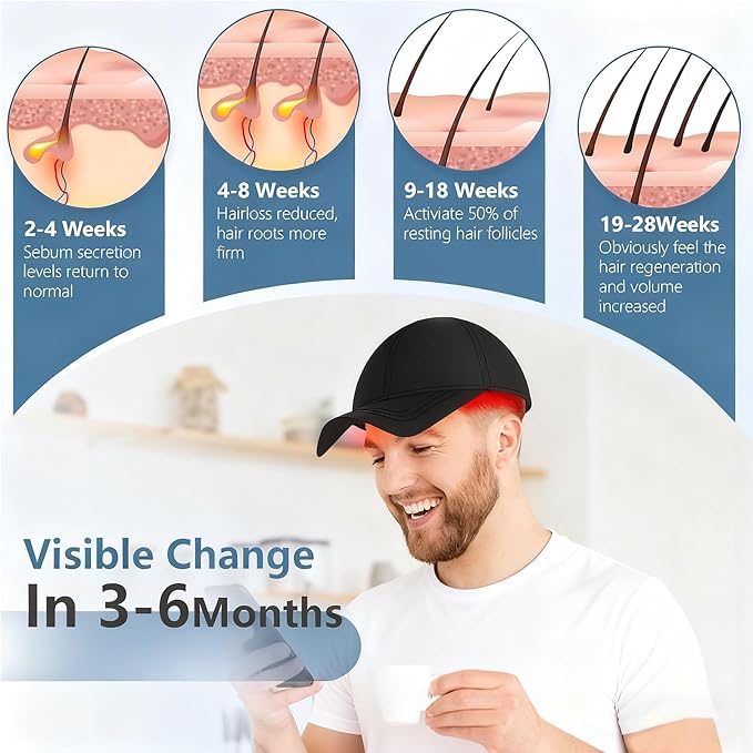 LLLT Laser Hair Growth Cap, Hair Growth Cap for Men Women - Lasers & LED Light Therapy Cap-Rechargeable Portable Laser Hair Growth Cap to Promote Hair Growth