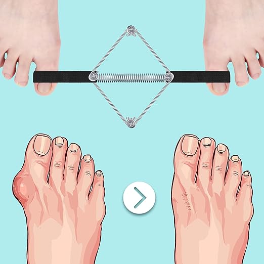 Tondiamo Pilates Toe Stretcher Bunion, Hallux Valgus Big Toe Strap Spacer Tension Bunion Exercise Band Stretchy Alignment Splint Restores Pain Relief for Women Men