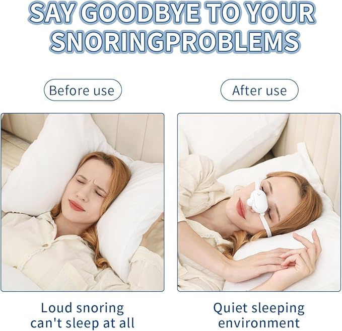 Smart Anti-Snoring Device,Smart Snore Stopper with Strong and Weak Modes for Snoring Reminder,Relief.Easy Use,AI Automatic Monitoring Portable Snore Solution for Home Office Travel (White)