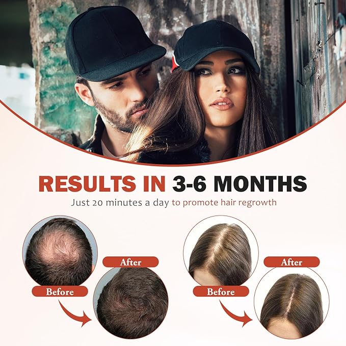 LLLT Laser Hair Growth Cap for Thinning Hair, 650nm Red Light Therapy Hair Regrowth Treatment, Full Scalp Coverage, Hands-Free & Rechargeable Hair Loss Solution for Men & Women, Black
