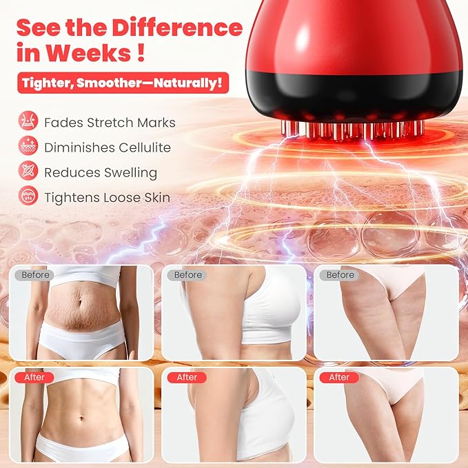 Lymphatic Drainage Massager, Anti-Cellulite Massager For Body Cellulite and Thigh & Belly Stretch Marks Reduction, Handheld Massage tools for Lymphedema & Lipedema, Sciatica Nerve Pain Relief Devices