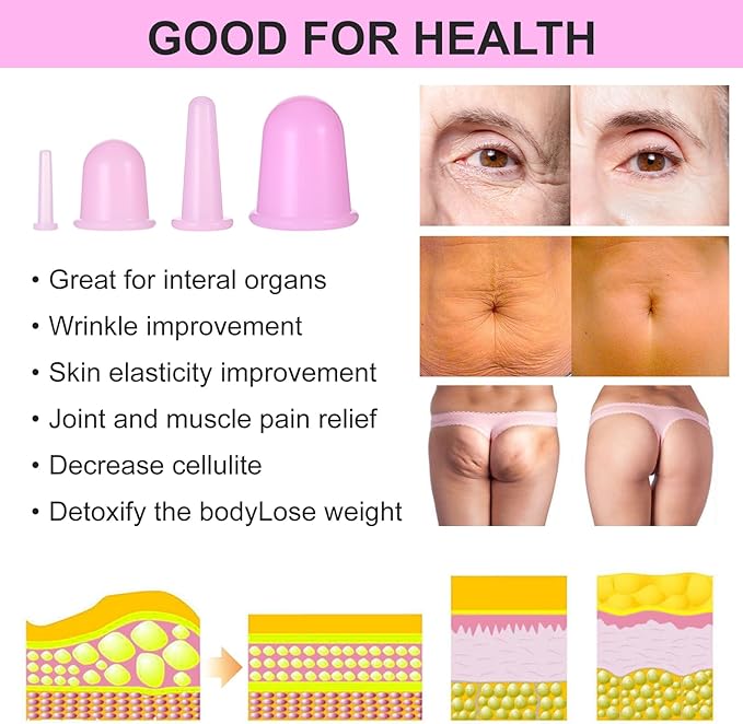 4 Pieces Facial Cupping Therapy Set Anti Cellulite Silicone Vacuum Cupping Cups Facial Cupping Treatment Anti Aging Beauty Tool for Face and Eye Cupping Massage (Pink 2 Small + 2 Large)