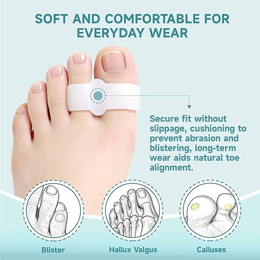 12 Pcs Bunion Corrector, Toe Separators for Women & Men with 2 Loops, Bunion Corrector for Women Big Toe, for Bunions and Overlap (White)