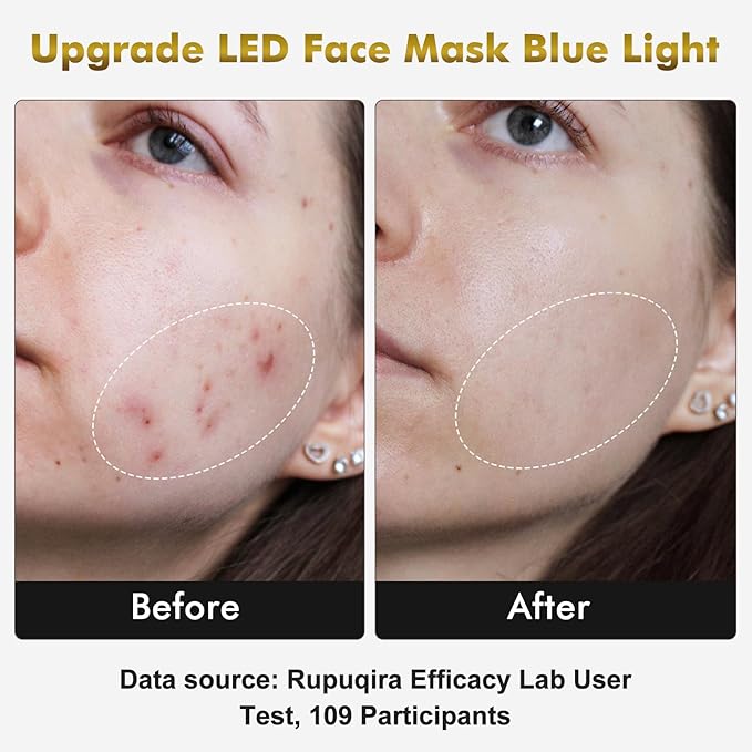 Red Light Therapy for Face & Neck Mask, Led Face Mask Light Therapy with 7 Colors, 309 LED Beads Silicone Facial Skin Care Device for Home SPA Beauty Salon