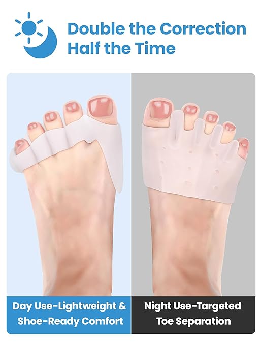 Toe Separators - Podiatrist Recommended, Toe Spacers for Men and Women, Breathable Bunion Corrector(2 pair)