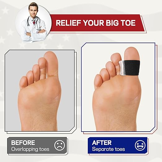 Orthopedic Gel Toe Separators for Overlapping Toes,Big Toe Spacers for Hallux Valgus Corrector with Shock Absorption, All-Day Comfort for Men & Women.