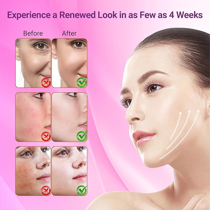 Red Light Therapy for Face - Red, Blue & Infrared Light Facial Skin Care Device with Eye Protection,Red Light Mask with Adjustable Strap for Home Use (3 Wavelengths, Sensitive Skin Tested)