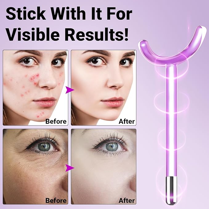 UUPAS Spare Violet Y-Shaped Tube (Glass Attachment)