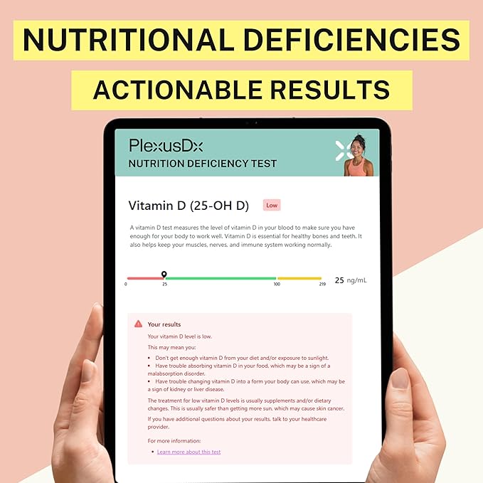 Vitamin and Iron Deficiency Test Home Kit | 7 Vital Biomarkers | Vitamin B12, Homocysteine, Hematocrit, Folate, Ferritin, Albumin, Vitamin D Test | At Home Nutrition and Blood Anemia Test Kit