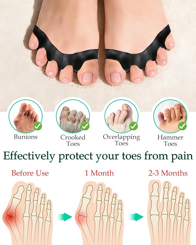 4PCS Silicone Toe Separators to Correct Toes Alignment for Women and Men, Toe Spacers Straightener for Bunion Relief, Hammertoes and Overlapping Toes (Extra Large)