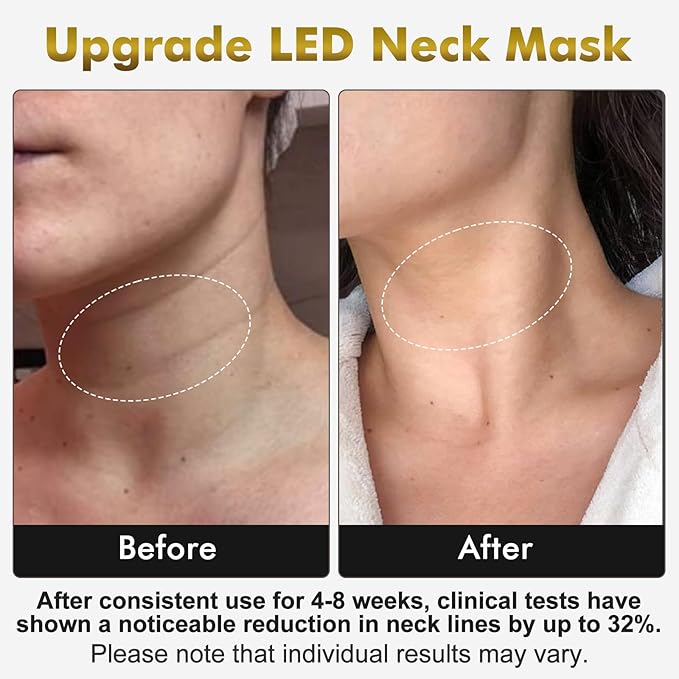 Red Light Therapy for Face & Neck Mask, Led Face Mask Light Therapy with 7 Colors, 309 LED Beads Silicone Facial Skin Care Device for Home SPA Beauty Salon