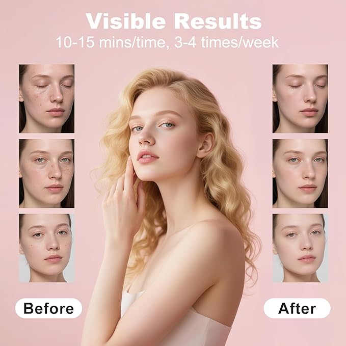 Red Light Therapy for Face, Portable Led Face Mask Light Therapy with Rechargeable Remote, 7 Color Mode Red Light Therapy with 850nm NIR, Home Use Skin Care Device (Pink)