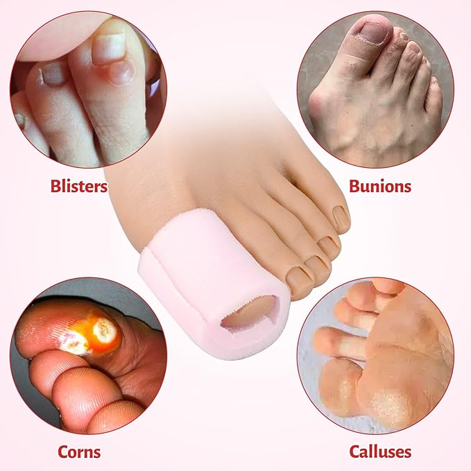 Ultrassist Toe Sleeve with Overlap Large Size 1" Inner Diameter 36" Roll, Sponge Toe Protectors for Blisters, Bunions, Corns