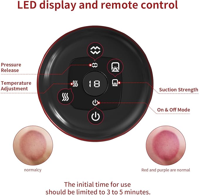 5-in-1 Smart Dynamic Cupping Therapy Massager Set, 12 Levels Heat & Suction Cupping Kit for Massage Therapy, Electric Cupping Device with Red Light Therapy for Back Pain, Knots, Muscle Soreness (Red)