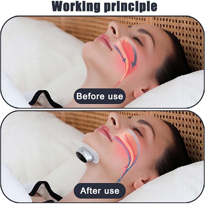 Smart Guard Anti Snore Device, Professional Anti-Snoring Device, Sleep Apnea Relief, Pulse Anti-Snoring Device for Men Women