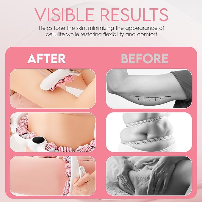 Cellulite Massage Roller, Fascia Blaster, Lymphatic Drainage Massager, Relieve Muscle Soreness, Body Sculpting Tool with Detachable Handles for Thighs, Legs, Buttocks, Gift Exfoliating Brush (Pink)