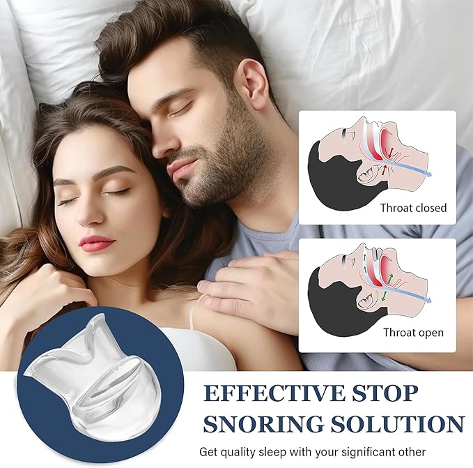Snoring Solution - Anti-Snore Device, Reusable Snore Solution Stopper for Men/Women - MF23