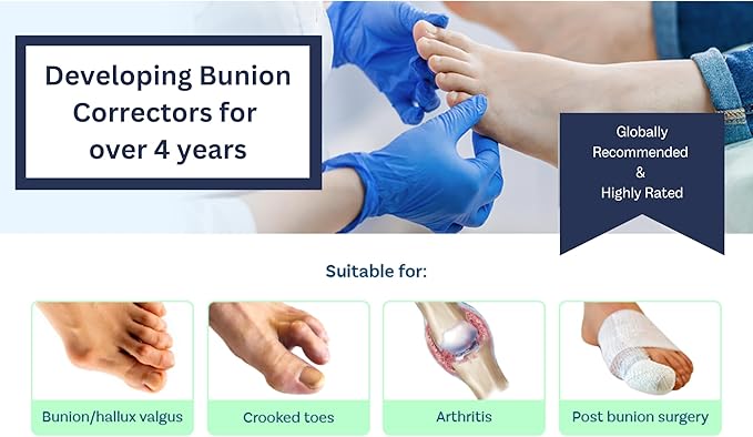 Caretras 2-Pack Bunion Corrector for Women & Men, Orthopedic Bunion Splint for Hallux Valgus Pain Relief, Big Toe Separator, Adjustable Day/Night Support, Comfortable Hammer Toe Straightener