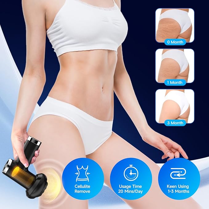Anti Cellulite Massage Tool, Body Sculpting Machine for Women, Lymphatic Drainage Device with Lipo Roller, Handheld Home Use for Belly Fat, Stomach, Thighs & Buttocks Sculpting (Black)