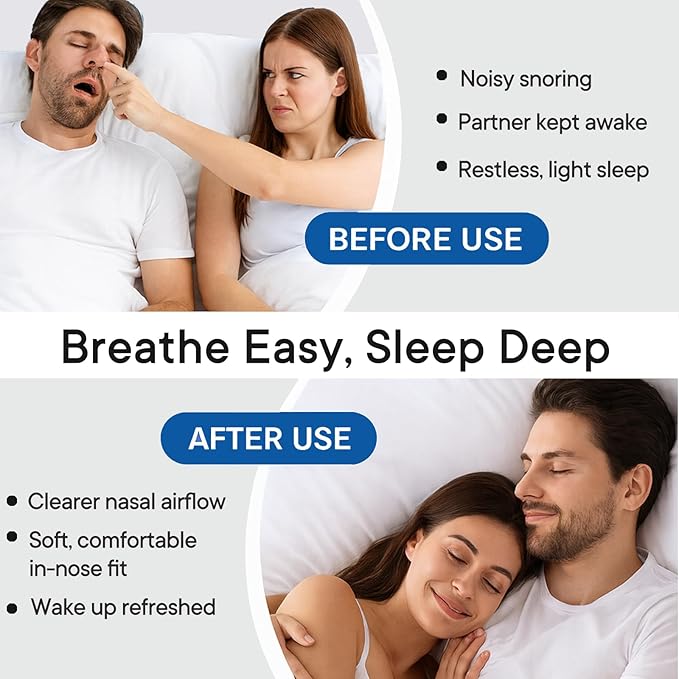 Anti Snoring Devices, Snoring Solution with Adjustable Snore Stopper, 3-Gear Fit, Improves Airflow, Reusable – 4 Pack