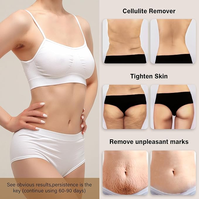 Cellulite Massager, Body Sculpting Tool, Cordless Handheld Body Cellulite Remove for Belly, Waist, Legs, Butt, Arms, Body Massager - Gifts for Women Mum