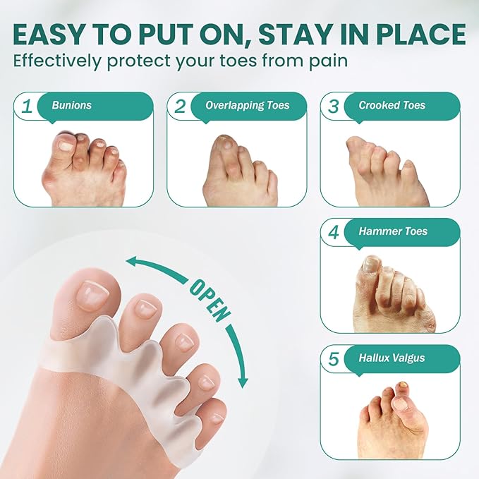 Welnove Toe Separators - 8 Pcs Toe Spacers for Women and Men - Restoring Toes to Their Original Shape - Silicone Toe Spreaders for Yoga Practice - Aloe Vera Infused
