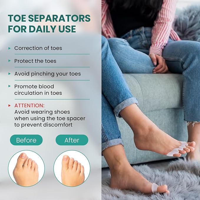 Welnove Toe Separators - 8 Pcs Toe Spacers for Women and Men - Restoring Toes to Their Original Shape - Silicone Toe Spreaders for Yoga Practice - Aloe Vera Infused