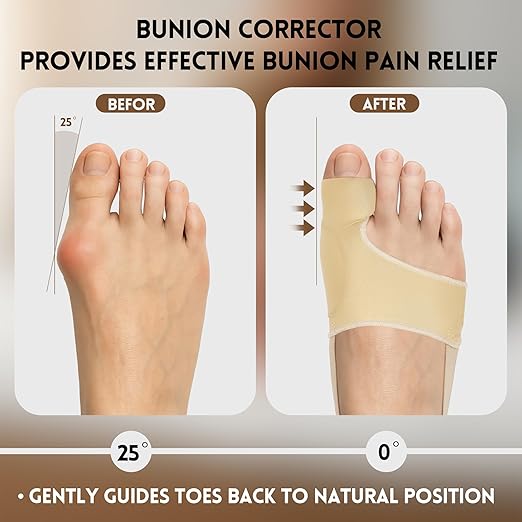 2 PCS Bunion Corrector for Women & Men - Big Toe Straightener with Splint & Pads,Breathable & Comfortable Big Toe Alignment Splint,Bunion Pain Relief Socks for Day/Night Support