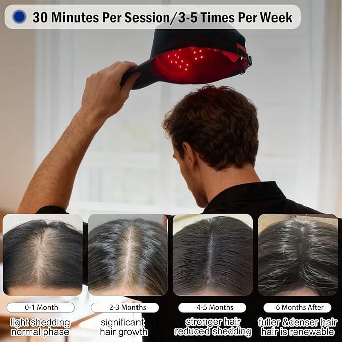 Laser Hair Growth Cap, Red Light Therapy Cap for Hair Regrowth, Blue Light Hair Care for Reduce Hair Loss in Men and Women