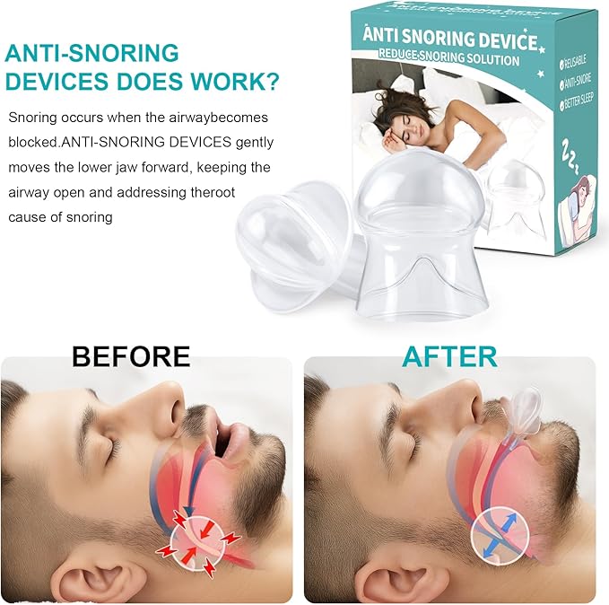 Anti Snoring Device - Snoring Solution Mouth Guard for Men and Women -F04