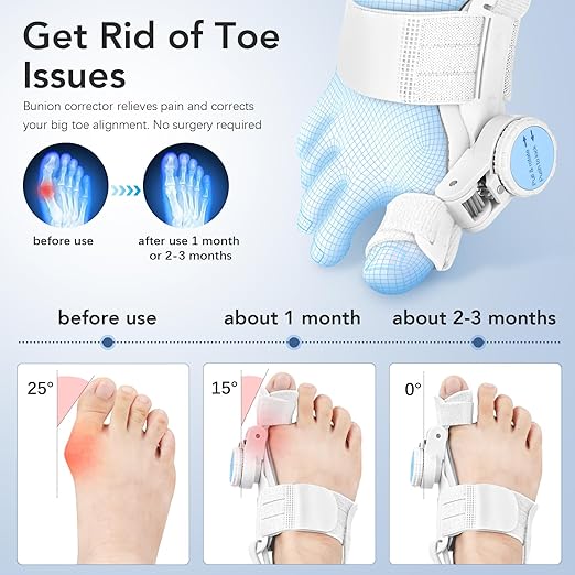 Bunion Corrector for Women Men: Big Toe Straightener Bunion Fix with Adjustable Knob-Orthopedic Bunions Splint Brace Toe Alignment Correction for Hallux Valgus Pain Relief Day/Night 1PCS (White)