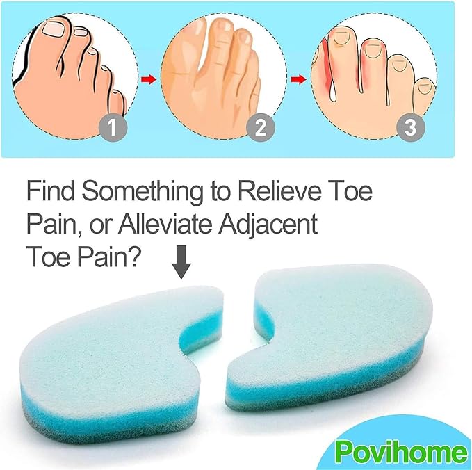 Povihome 20 Pack Foam Toe Spacers(2/5" Thick), 3-Layer Toe Separators - Large Size - to Align Crooked, Overlapping Toe, Relieve Corn, Blister and Reduce Irritation