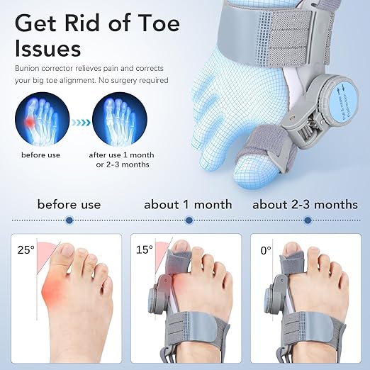 Bunion Corrector for Women Men: Big Toe Straightener Bunion Fix with Adjustable Knob-Orthopedic Bunions Splint Brace Toe Alignment Correction for Hallux Valgus Pain Relief Day/Night 1PCS (Grey)