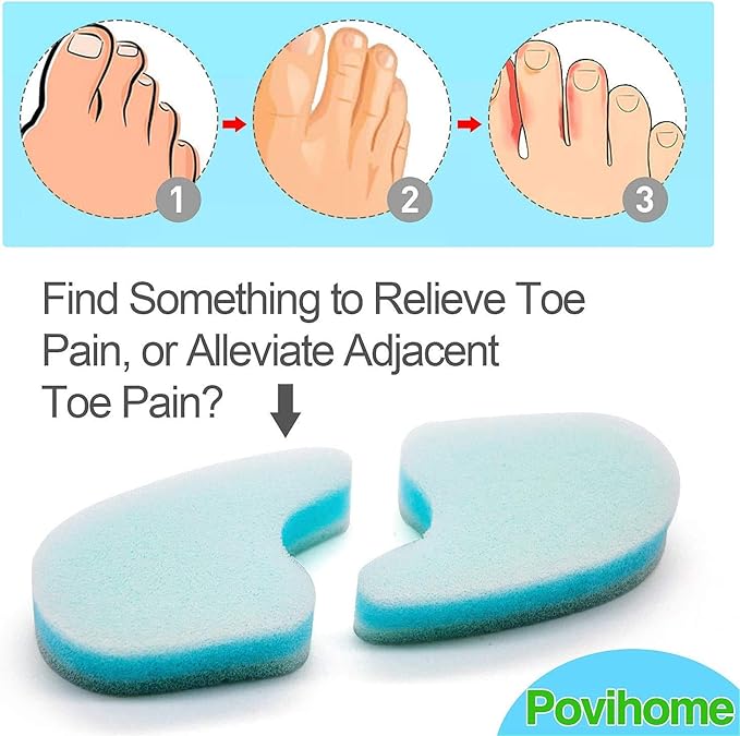 Povihome 10 Pack Foam Toe Spacers(2/5" Thick), 3-Layer Toe Separators - Large Size - to Align Crooked, Overlapping Toe, Relieve Corn, Blister and Reduce Irritation