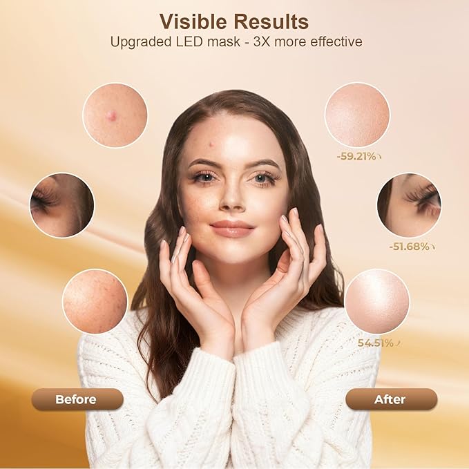 Red Light Therapy for Face, LED Face Mask Light Therapy, Rechargeable Red Light Therapy Mask for Face with Comfortable Light-Blocking Eye Protection & Timing Function At Home, Black