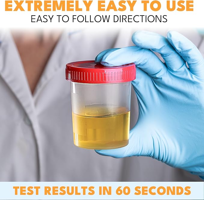 14-URS Reagent Test Strips [120 ct] for Urinalysis and Detection of UTI, LEK, Pro, Ket and More, Comprehensive Test - for Men & Women at Home Use with Reliable Results in 60 sec.