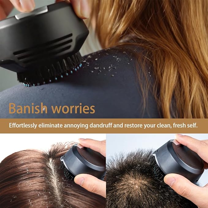 Electric Dandruff Comb,scalp-treatments, Eliminate dandruff and protect your scalp, maintaining clean and beautiful hair appearance(Unisex)