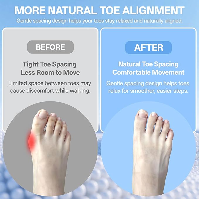 Toe Separators for Women & Toe Spacers for Men, 6 Pairs Soft Silicone for Daily Comfort - Bunion Relief, Toe Alignment, Pedicure