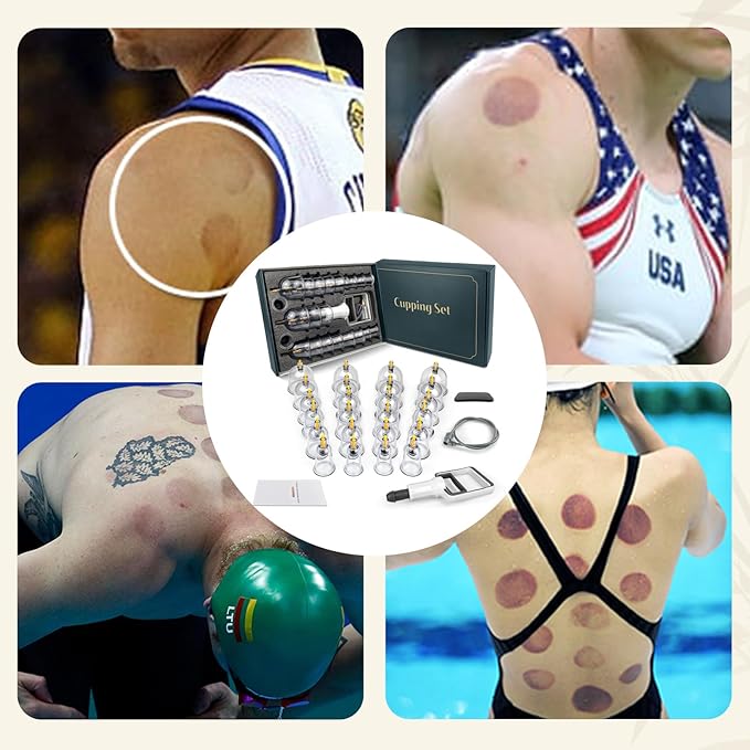 Cupping Kit for Massage Therapy - 24 Cups Professional Massage Cups Set with Manual Pump, Vacuum Cupping Therapy Set for Cellulite Reduction Muscle Pain Relief