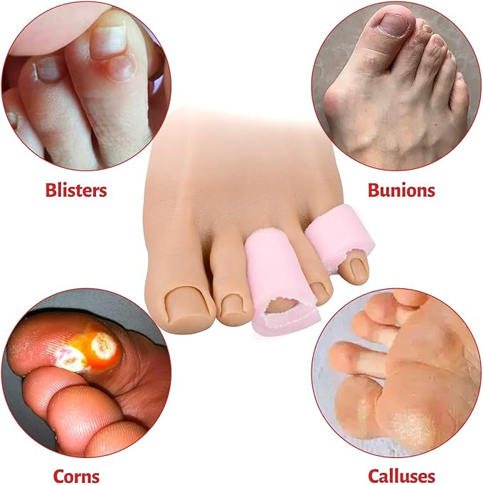 Ultrassist Toe Sleeve with Overlap Small Size 5/8" Inner Diameter 36" Roll, Sponge Toe Protectors for Blisters, Bunions, Corns
