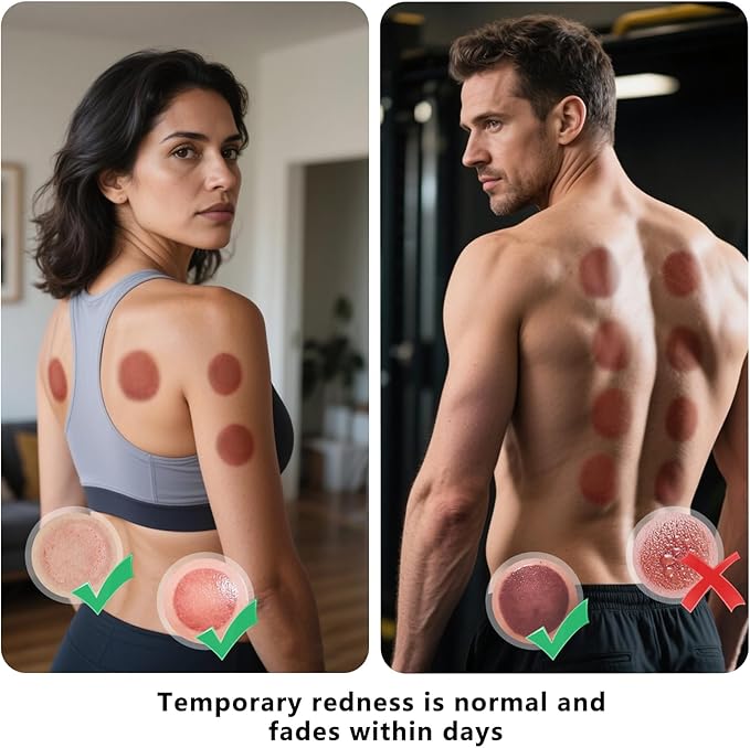 LIFELEC Smart Cupping Therapy Set - 6 Cups (Large/Press/Move), 12-Level Heat & Suction, Smart Red Light Therapy - Dual Massagers for Simultaneous Use - 2 Pack Set for Athletes, Fitness, Pain Relief